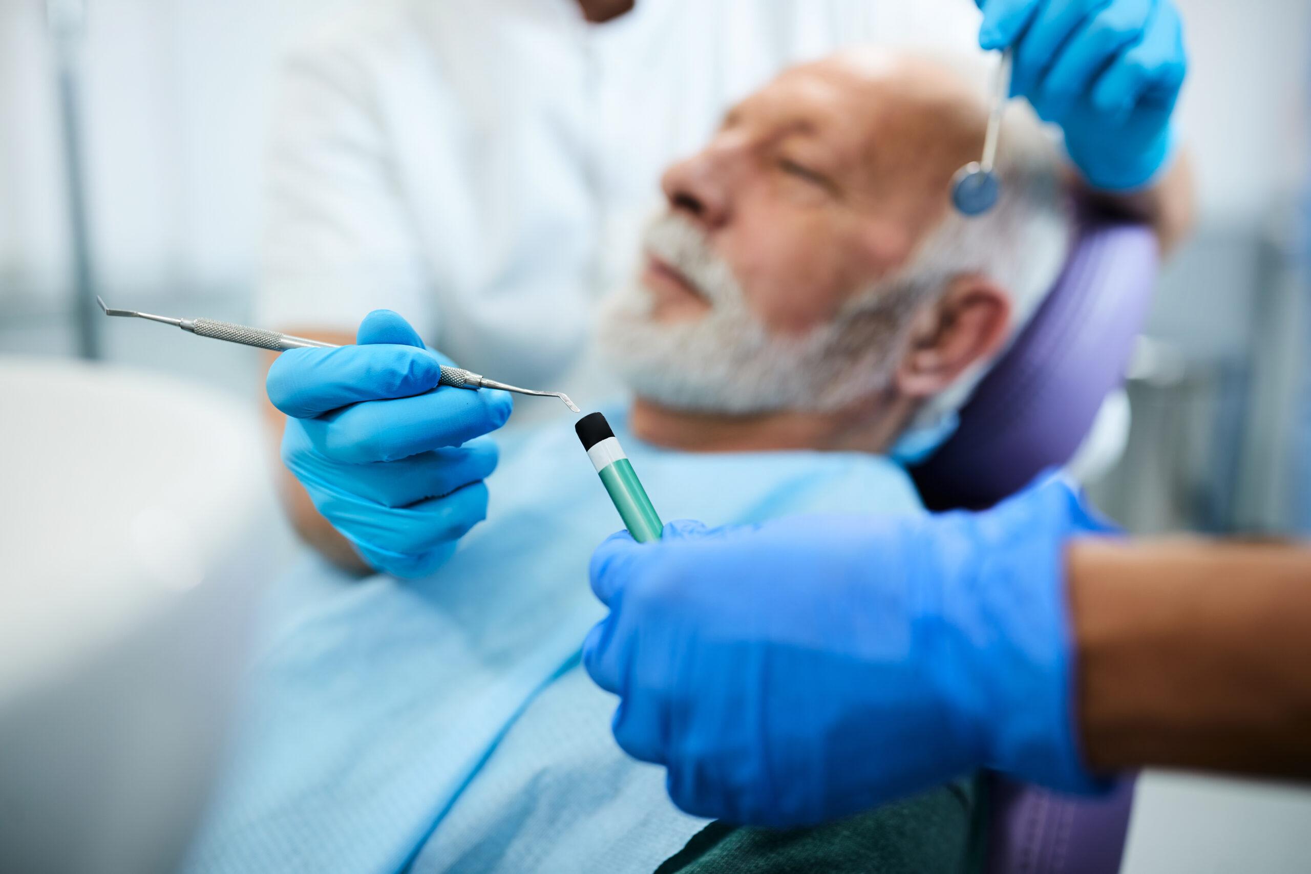 Close-up of dentist using dental filling while working on senior man's teeth.